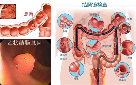 萎縮性胃炎真的“很?chē)樔恕?？看完這“七個(gè)事實(shí)”你就明白了